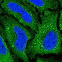 SLC38A5 Antibody, Novus Biologicals:Antibodies:Primary Antibodies